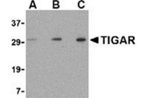 Western blot analysis of TIGAR in EL4 cell lysate with this product at (A) 0. (TIGAR 抗体  (Center))