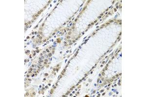Immunohistochemistry of paraffin-embedded human stomach using TIA1 antibody (ABIN6293426) at dilution of 1:100 (40x lens). (TIA1 抗体)