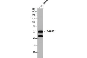 Western Blotting (WB) image for anti-Calcium/calmodulin-Dependent Protein Kinase II delta (CAMK2D) antibody (ABIN2856806)