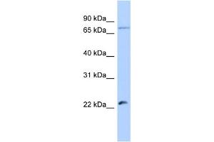 Western Blotting (WB) image for anti-Heat Shock Transcription Factor, Y Linked 2 (HSFY2) (Middle Region) antibody (ABIN2784596)