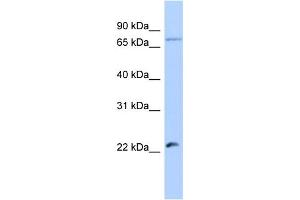 Host:  Rabbit  Target Name:  HSFY2  Sample Type:  Jurkat Whole Cell lysates  Antibody Dilution:  1. (HSFY2 抗体  (Middle Region))