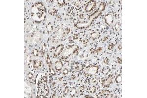 Immunohistochemical staining (Formalin-fixed paraffin-embedded sections) of human kidney with NCOA6 polyclonal antibody  shows nuclear positivity in cells of tubules and glomeruli.