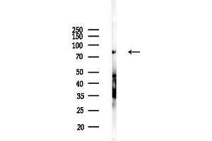 anti-Engulfment and Cell Motility 1 (ELMO1) (C-Term) antibody