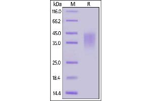 Biotinylated Human / Cynomolgus / Rhesus macaque CD28, His,Avitag on  under reducing (R) condition. (CD28 Protein (CD28) (AA 19-152) (His tag,AVI tag,Biotin))