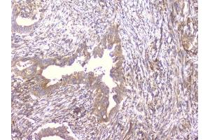 IHC analysis of PCDH15 using anti-PCDH15 antibody (ABIN6719362).