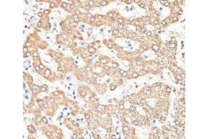 Immunohistochemistry of paraffin-embedded Human liver using KIR3DS1 Polyclonal Antibody at dilution of 1:100 (40x lens). (KIR3DS1 抗体)