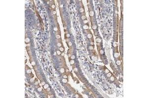 Immunohistochemical staining of human duodenum with PSMG3 polyclonal antibody  shows cytoplasmic positivity in glandular cells. (PSMG3 抗体)