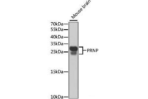 Western blot analysis of extracts of Mouse brain using PRNP Polyclonal Antibody at dilution of 1:1000. (PRNP 抗体)