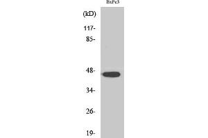Western Blotting (WB) image for anti-Androgen Receptor beta 2 (Ser346) antibody (ABIN5960222) (Androgen Receptor beta 2 抗体  (Ser346))