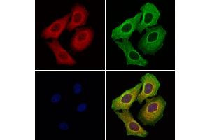 ABIN6257549 and ABIN6276234 staining Hela cells by IF/ICC. (VIPR1 抗体  (Internal Region))