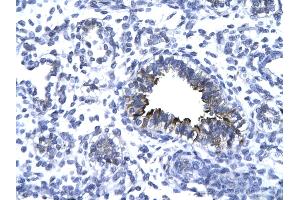 Rabbit Anti-KIF5A antibody   Paraffin Embedded Tissue: Human Lung cell Cellular Data: bronchiole epithelium of renal tubule Antibody Concentration: 4. (KIF5A 抗体  (Middle Region))
