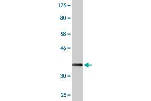 Western Blot detection against Immunogen (36. (KLHL1 抗体  (AA 61-160))