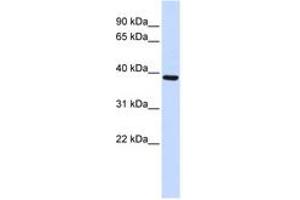 Image no. 1 for anti-F-Box Protein 24 (FBXO24) (AA 304-353) antibody (ABIN6743158) (FBXO24 抗体  (AA 304-353))