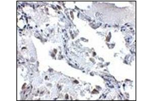 Immunohistochemistry of SH3BP4 in human lung tissue with this product at 5 μg/ml. (SH3BP4 抗体  (C-Term))