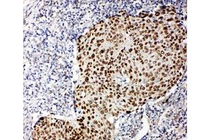 IHC-P testing of human lung cancer tissue