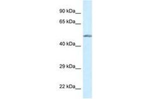 Image no. 1 for anti-Glucokinase (Hexokinase 4) (GCK) (AA 84-133) antibody (ABIN6747601) (GCK 抗体  (AA 84-133))