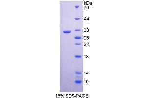 SDS-PAGE analysis of Human COL4a5 Protein. (COL4a5 蛋白)