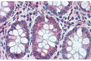 Rabbit Anti-GATA6 Antibody Catalog Number: ARP31859 Paraffin Embedded Tissue: Human Colon Antibody Concentration: 5 ug/ml (GATA6 抗体  (Middle Region))