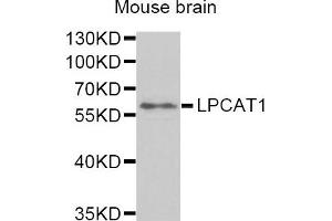 Western Blotting (WB) image for anti-Lysophosphatidylcholine Acyltransferase 1 (LPCAT1) antibody (ABIN1876240) (LPCAT1 抗体)