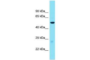Host: Rabbit  Target Name: Glp1r  Sample Tissue: Mouse Liver lysates  Antibody Dilution: 1. (GLP1R 抗体  (Middle Region))