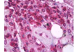 Anti-CD45RO antibody IHC of human spleen, t lymphocytes. (CD45RO 抗体)