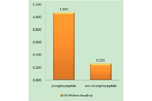 Immunohistochemistry analysis of paraffin-embedded human brain tissue using Ephrin B1/B2 (Phospho-Tyr329) antibody. (Ephrin B1/B2 (pTyr329) 抗体)