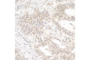 Immunohistochemistry (IHC) image for anti-Ankyrin Repeat-Containing Protein (EHMT2) (C-Term) antibody (ABIN7453554) (EHMT2 抗体  (C-Term))
