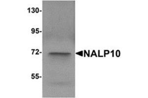 Western blot analysis of NALP10 in human brain tissue lysate with NALP10 antibody at 1 μg/ml. (NLRP10 抗体  (N-Term))