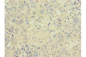 Immunohistochemistry (IHC) image for anti-Calcium Channel, Voltage-Dependent, alpha 2/delta Subunit 2 (CACNA2D2) (AA 20-200) antibody (ABIN7175581)