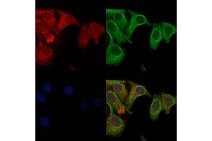 ABIN6261041 and ABIN6272826 staining Hela cells by IF/ICC.