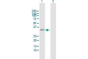 Western Blotting (WB) image for anti-Cerberus 1 Homolog (Xenopus Laevis) (CER1) (AA 1-267) antibody (ABIN522810)