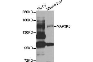 Western blot analysis of extracts of various cell lines, using MAP3K5 antibody. (ASK1 抗体  (AA 1175-1374))