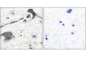Immunohistochemistry analysis of paraffin-embedded human brain tissue, using RASH/RASK Antibody. (RASH/RASK (AA 1-50) 抗体)