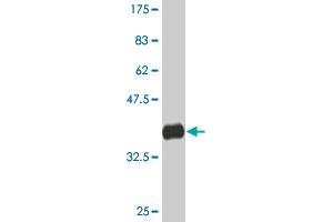 Western Blot detection against Immunogen (36. (CHD4 抗体  (AA 1632-1730))