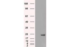 Western Blotting (WB) image for anti-Adenylate Kinase 1 (AK1) antibody (ABIN1496517) (Adenylate Kinase 1 抗体)