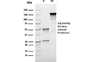 SDS-PAGE Analysis Purified ER-beta Mouse Monoclonal Antibody (ESR2/3005). (ESR2 抗体)