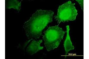Image no. 2 for anti-Hematopoietic Cell-Specific Lyn Substrate 1 (HCLS1) (AA 266-356) antibody (ABIN598726) (HCLS1 抗体  (AA 266-356))