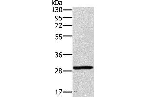 Western blot analysis of 293T cell, using EDA2R Polyclonal Antibody at dilution of 1:450 (Ectodysplasin A2 Receptor 抗体)