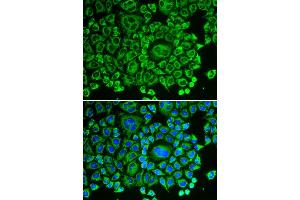 Immunofluorescence analysis of HeLa cell using ARHGDIA antibody. (ARHGDIA 抗体)
