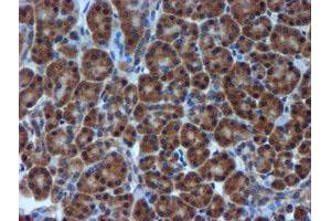 Image no. 1 for anti-Metalloproteinase Inhibitor 2 (TIMP2) antibody (ABIN1501393) (TIMP2 抗体)