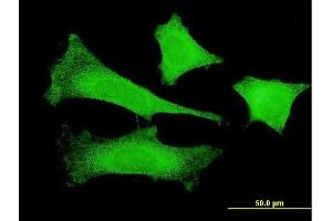 Immunofluorescence of monoclonal antibody to FBXO4 on HeLa cell. (FBXO4 抗体  (AA 1-387))