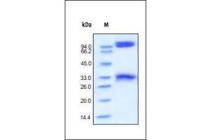 Human BACE-1, Fc Tag on SDS-PAGE under reducing (R) condition. (BACE1 Protein (AA 22-457) (Fc Tag))