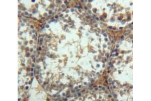 Used in DAB staining on fromalin fixed paraffin-embedded Testis tissue (Insulin Like Protein 3 (AA 63-129) 抗体)