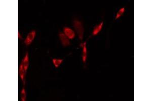 Immunofluorescence (fixed cells) (IF/ICC) image for anti-Solute Carrier Family 9 (Sodium/hydrogen Exchanger), Member 8 (SLC9A8) (C-Term) antibody (ABIN6258404)
