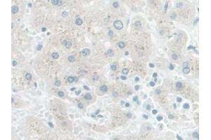 DAB staining on IHC-P; Samples: Human Liver Tissue (PDE1A 抗体  (AA 2-318))