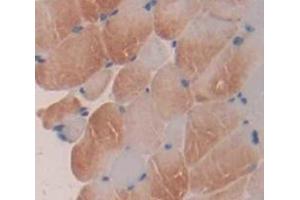 Immunohistochemistry (IHC) image for anti-Arachidonate 5-Lipoxygenase (ALOX5) (AA 374-536) antibody (ABIN1174531)