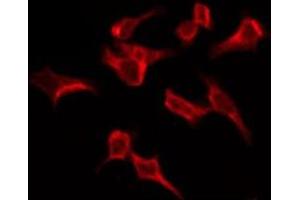 ABIN6276149 staining HeLa by IF/ICC. (OR4C6 抗体  (Internal Region))