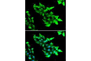 Immunofluorescence analysis of HeLa cell using KRIT1 antibody. (KRIT1 抗体)