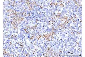 IHC analysis of PTPIP51/RMDN3 using anti-PTPIP51/RMDN3 antibody (ABIN7601775).