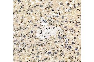 Immunohistochemistry of paraffin embedded rat placenta using notch3 (ABIN7074862) at dilution of 1:700 (250x lens) (NOTCH3 抗体)
